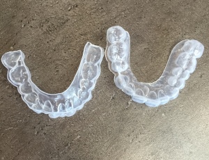 Gouttières à appliquer sur les dents
