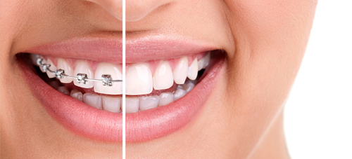 Orthodontie dentiste Amouyal Paris 16