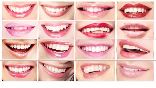 La ligne du sourire Richard Amouyal dentiste Paris 16